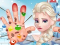 Elsa Hand Doctor
