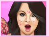 Selena Gomez Acne Invasion