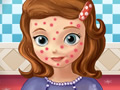Squeeze Sofia Pimples